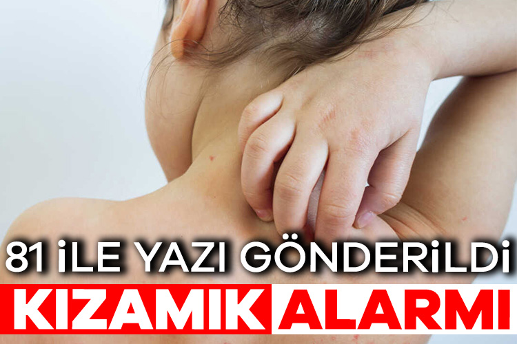 Sağlık Bakanlığı’ndan 81 ile ‘kızamık’ ile ilgili yazı gönderildi