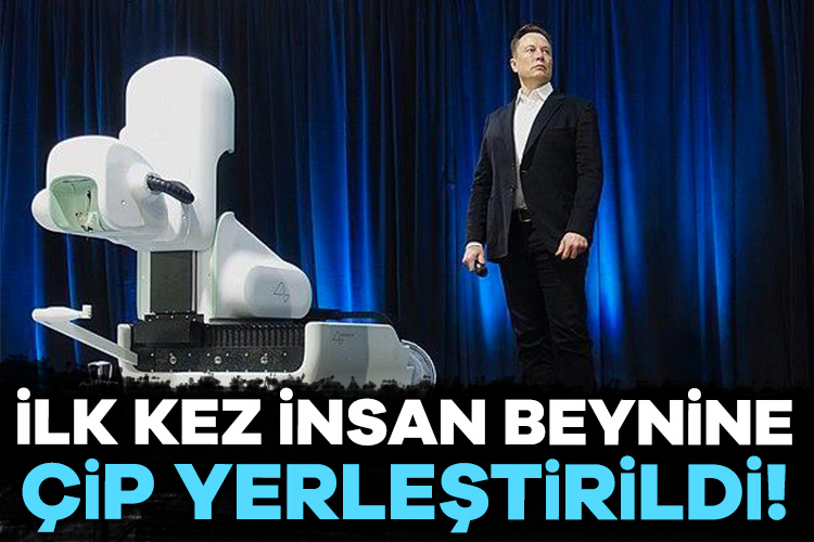 Elon Musk duyurdu: İlk kez insan beynine çip yerleştirildi!