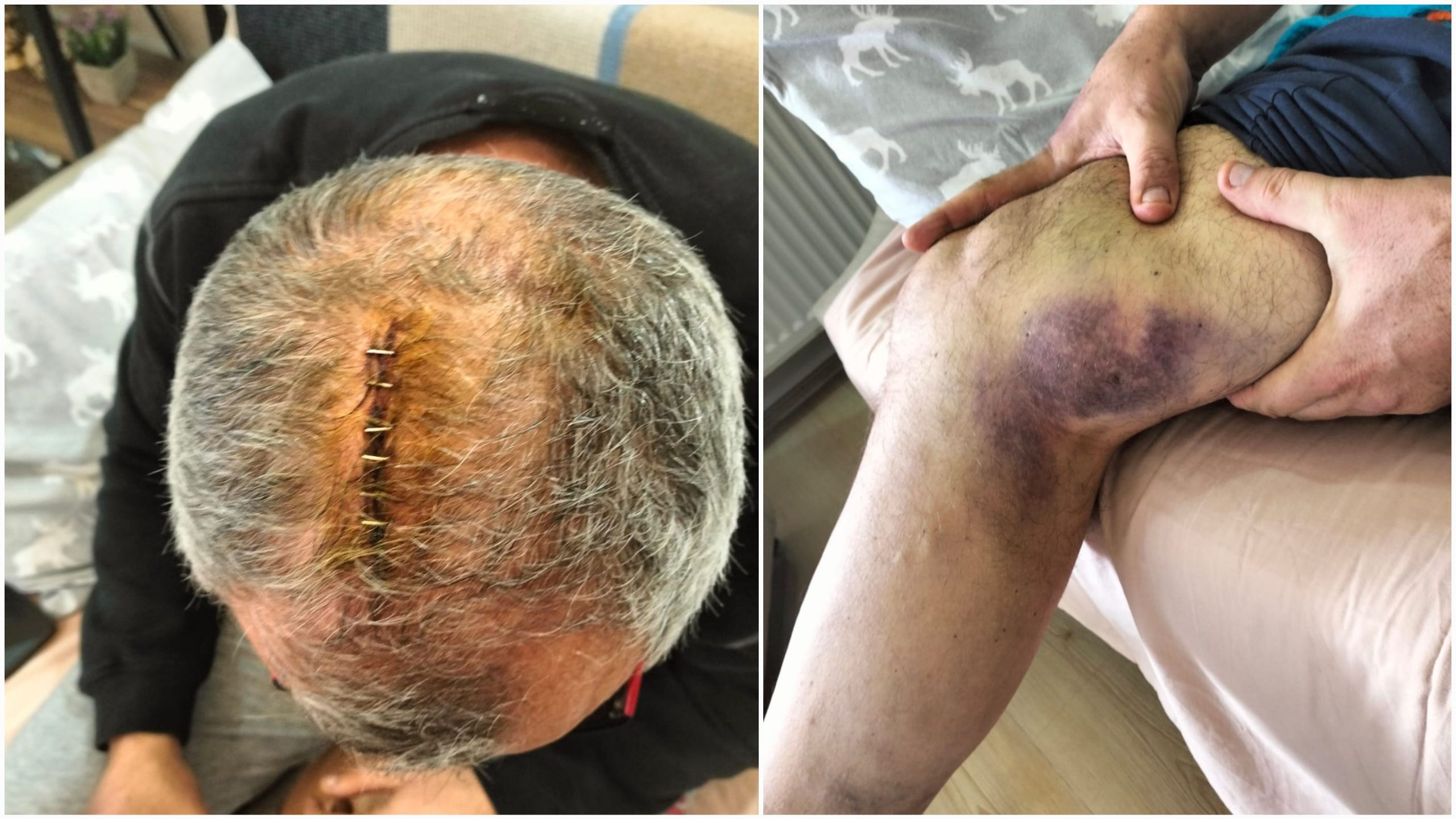 EĞİTİM SEN DARP EDİLEN ERDEKLİ EĞİTİMCİNİN YANINDA