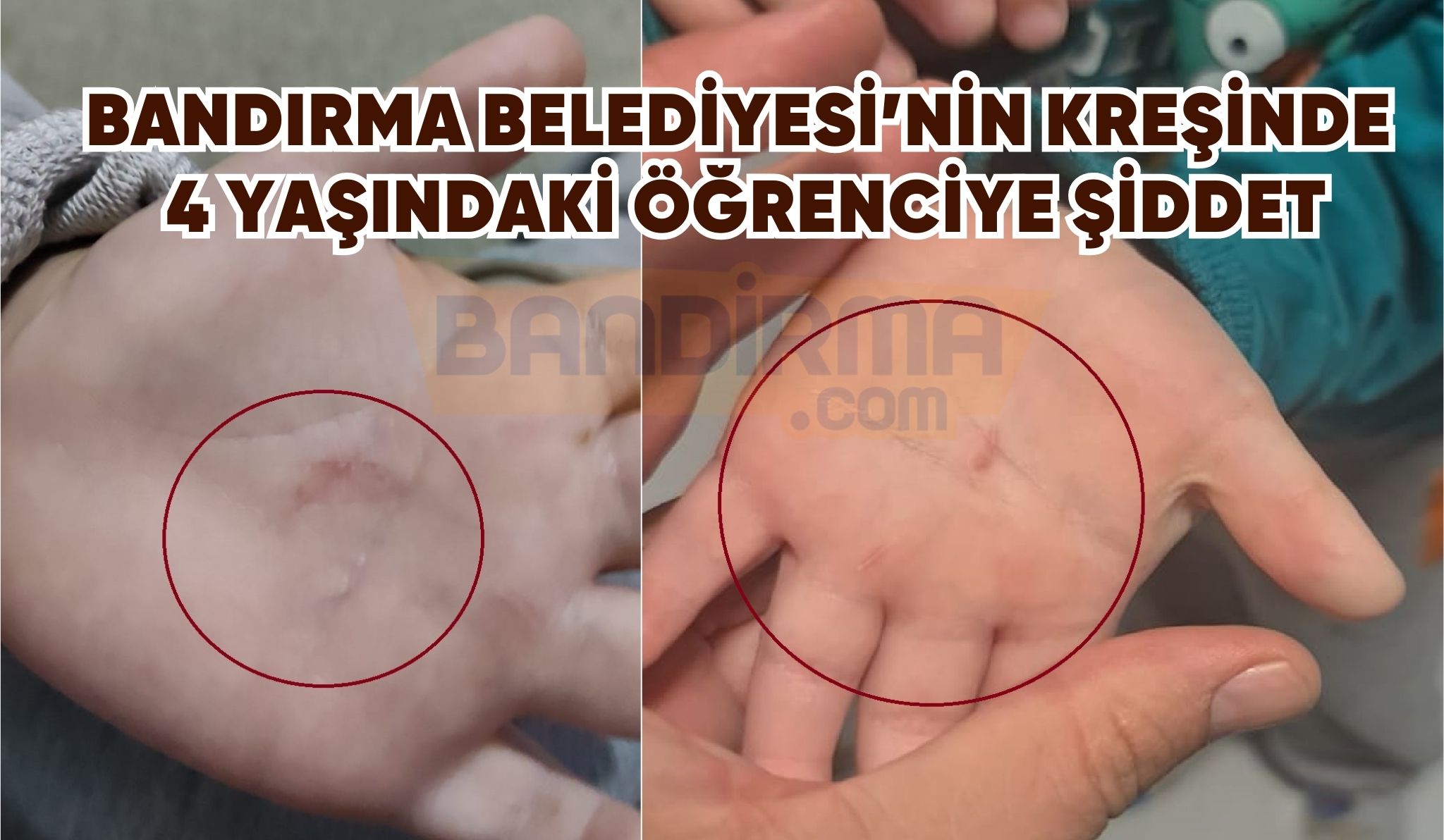 BANDIRMA BELEDİYESİ’NİN KREŞİNDE 4 YAŞINDAKİ ÖĞRENCİYE ŞİDDET